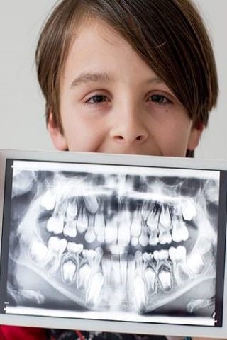 رادیوگرافی-دندان-کودکان-در-شیراز-دارای-اتاق-مخصوص-کودک-1