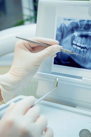 عکس_برداری-دندان-و-دهان